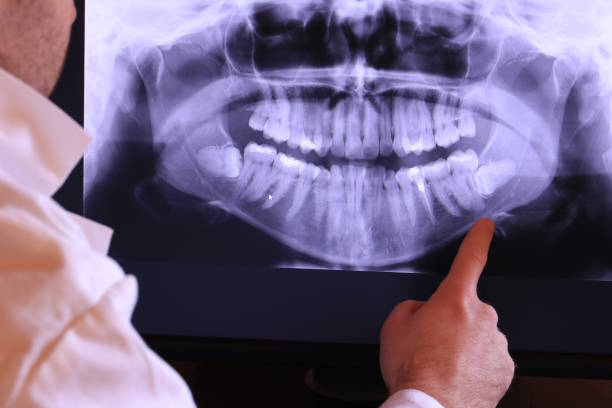 Best Teeth Whitening  in Paxton, IL