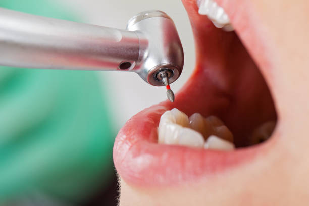 Best Urgent Tooth Repair  in Paxton, IL